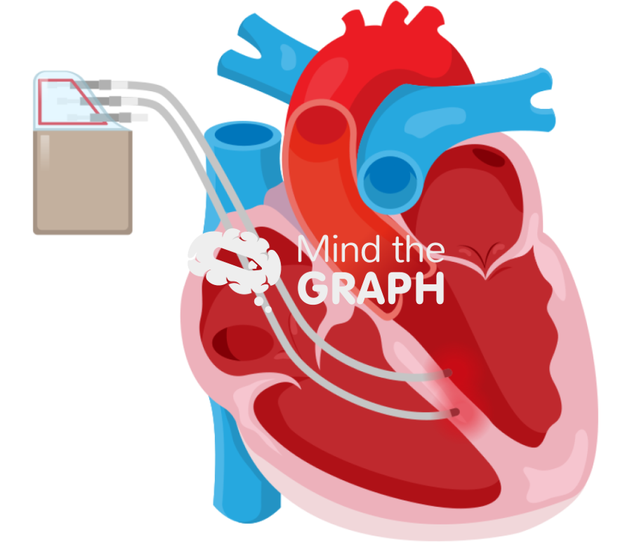Cardiac contractility modulation therapy Icons, Symbols, Pictures, and Images